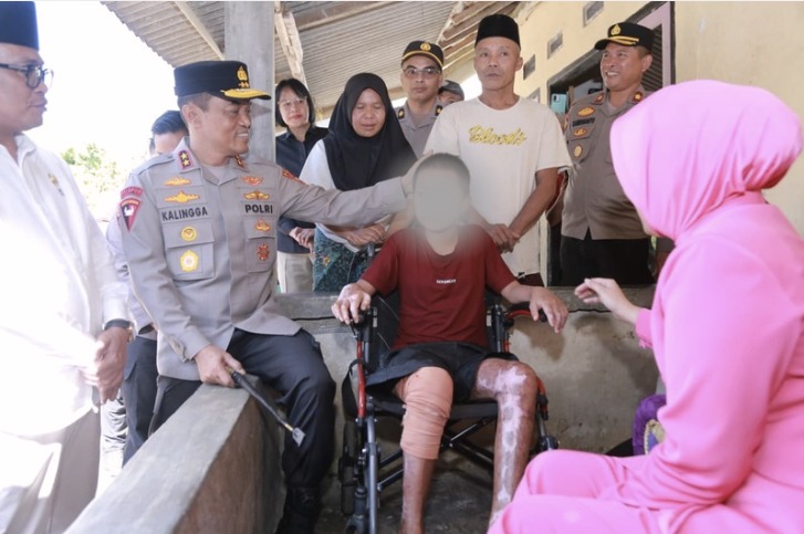 Jenguk Korban di Ponpes Lombok Tengah, Kapolda NTB Janji Tuntaskan Kasus dan Kawal Restitusi 2 IMG 20260709 WA0002