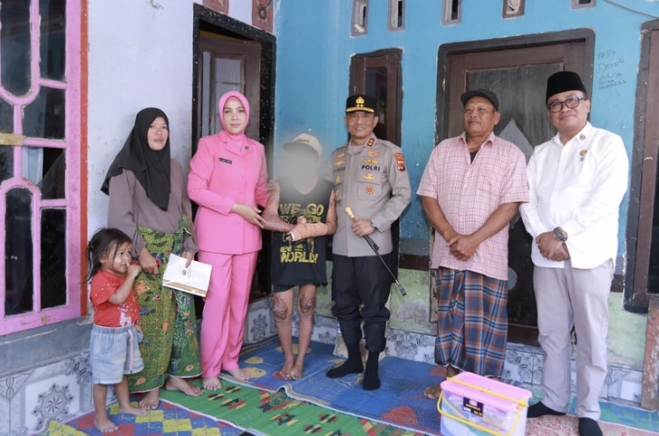 Jenguk Korban di Ponpes Lombok Tengah, Kapolda NTB Janji Tuntaskan Kasus dan Kawal Restitusi 1 IMG 20260709 WA0003